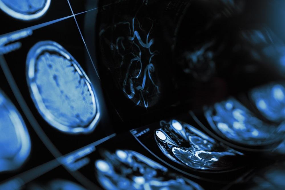 One Imaging Software Company Expects Positive Operating Cash Flow for FY25 – M7T