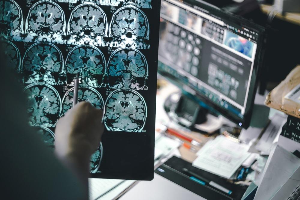 One Neuroscience Technology Company Stock Facing Resistance at Current Level - CGS