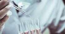An Update on One Healthcare Stock – Smith & Nephew