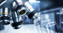 Technical Analysis on One NASDAQ Listed- Health Technology Stock- AKRO