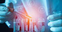 Key Insights on One NASDAQ-Listed Health Care Company: Harmony Biosciences Holdings, Inc
