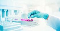Technical Analysis on One NASDAQ- Listed Pharmaceutical Stock- SIGA