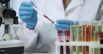 Technical Analysis on One NASDAQ- Listed Health Services Stock- BDSX