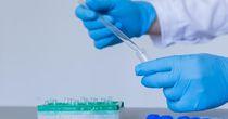 Technical Analysis on One NASDAQ- Listed Biotechnology Stock- AARD