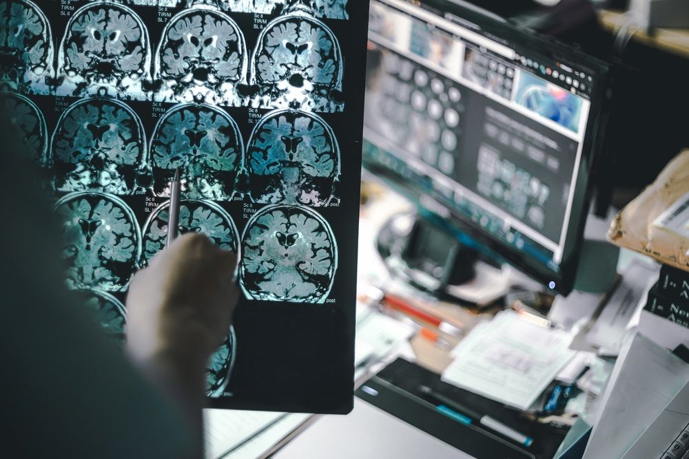 Book Profits on This Small-Cap Pharma Stock – CPRX