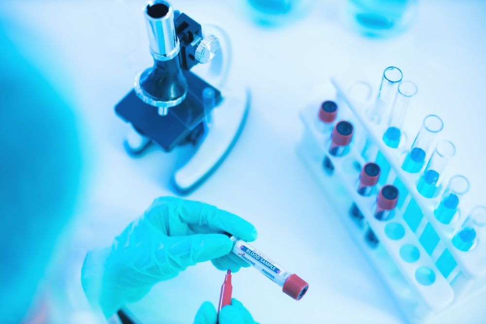 Hold On to This Small-Cap Health Care Equipment Stock – VIVO