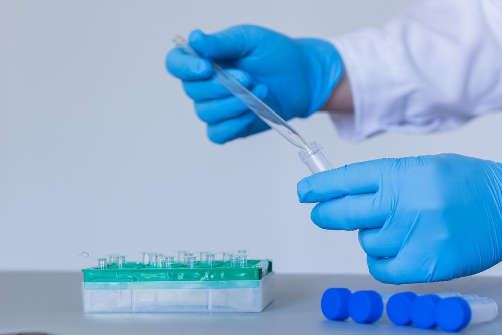 Technical Analysis on One NASDAQ- Listed Biotechnology Stock- AARD